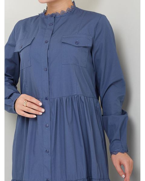 فستان من القماش الطبيعي مزين بالدانتيل وأزرار (نيلي)